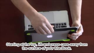 Macbook Armorbox Installation Video  IBlason [upl. by Stoddard571]