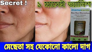 Mama Earth Bye Bye Blemishes  Usage  Overview  এক ক্রিমেই মেছেতার দাগ সহ সব দাগ ভ্যানিশ [upl. by Davies]