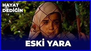 Hayat Dediğin  Eski Yara [upl. by Cloris]