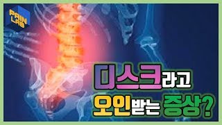 디스크라고 오인받는 증상디스크 의증허리디스크요추디스크요통허리통증다리저림다리당김이상근증후근 의심자 필수 시청  페인랩이 말하는 통증 이야기 [upl. by Odanref]