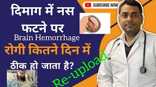 dimag ki nas fatna  Brain Hemorrhage in hindi  दिमाग की नस फटना कितने टाइम में ठीक हो जाता है [upl. by Pelagia]