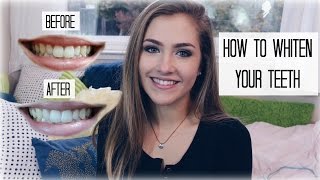 HISMILE TEETH WHITENING KIT REVIEW  Mel Joy [upl. by Alister]