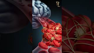 Science Of Stroke stroke shorts strokeeducation strokesupport [upl. by Janel334]