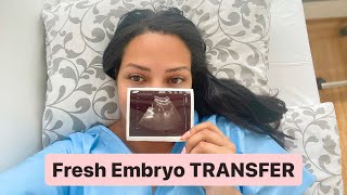 Fresh Embryo TRANSFER [upl. by Nnyw738]