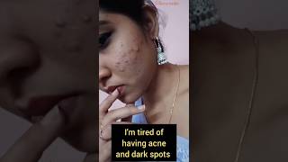 HOW TO GET CLEAR SKINEASY SKIN CARE ROUTINE ✨skincare skinbrightening skincareroutine acne [upl. by Bilski496]