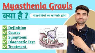 Myasthenia Gravis in Hindi  Causes Symptoms And Treatment of Myasthenia Gravis [upl. by Buhler]