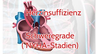 Herzinsuffizienz Schweregrade  NYHA Stadien [upl. by Mikkanen]