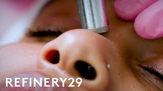 What Microdermabrasion Looks Like Up Close  Macro Beauty  Refinery29 [upl. by Acinomad]