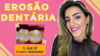 EROSÃO DENTÁRIA  O que você precisa saber Rebeca Aladim [upl. by Kariotta227]