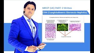 MRCP UK Part2 Written CGN CryoGlobuliNameia Cryoglobulinaemia [upl. by Fortunna60]