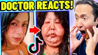 Plastic Surgeon Reacts to EXTREME Plastic Surgery TikTok Videos [upl. by Hubie]