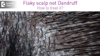 Get rid of itchy white flaky scalp which is not dandruff  Dr Rashmi Ravindra Doctors Circle [upl. by Luben]