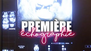 LA PREMIÈRE ÉCHOGRAPHIE PREMIER TRIMESTRE  VLOG GROSSESSE [upl. by Gathard]