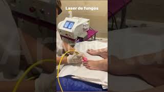 Arfurla laser nail fungus treatment equipment with 980nm 600um optical fiber toenail fungusremoval [upl. by Alverta]