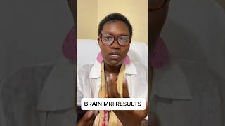 BRAIN MRI RESULTS are in…cancersurvivor triplenegativebcgodisgood [upl. by Auria]