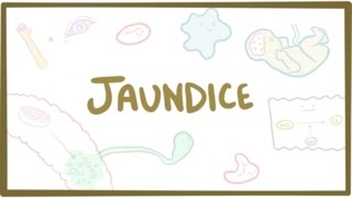 Jaundice  causes treatment amp pathology [upl. by Irrep312]