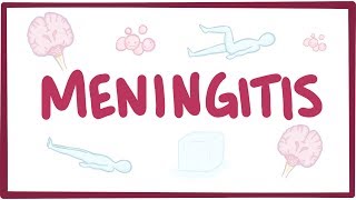 Meningitis  causes symptoms diagnosis treatment pathology [upl. by Pelpel]