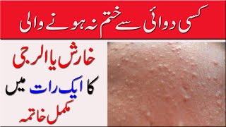 Kharash الرجی ka fori ilaj Top 3 Natural Remedies You Need to Try [upl. by Laemsi799]