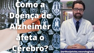 ENTENDA COMO A DOENÇA DE ALZHEIMER AFETA O CÉREBRO [upl. by Alyworth]