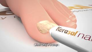 Kerasal Nail Restore Healthy Nail Appearance 30 Sec [upl. by Dimphia]