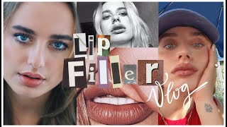 spilling the tea on my lip filler  los angeles daily vlog [upl. by Okoyk]