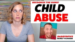 DaddyOFive  CHILD ABUSE [upl. by Rainger]