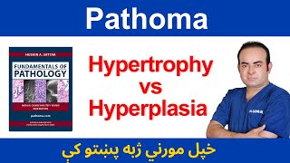 Hypertrophy VS Hyperplasia  Dr Sadiq Ali [upl. by Ecirtael]