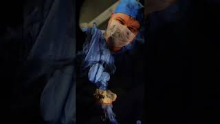 Liposuction And BBL Surgery In Turkey l Plastic Surgery shorts [upl. by Neri97]