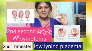 Low lyning placenta  placenta previa 2nd trimester in pregnancy viralvideo trending vlogs [upl. by Ahsiuq]