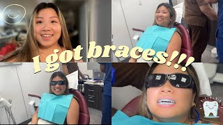 Getting braces vlog [upl. by Rettig]