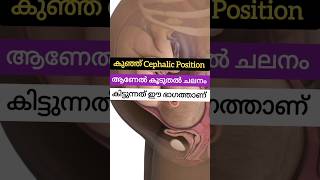 Cephalic positionBaby Movement Malayalampregnancy fetalkick [upl. by Gemina]