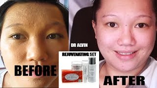 REVIEW REJUVENATING SET BY DRALVIN PROFESSIONAL SKIN CARE [upl. by Ahseiyt]