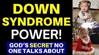 Down Syndrome Secrets Down Syndrome Awareness 2024 [upl. by Fabrianne]