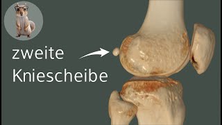 Die zweite Kniescheibe  die Fabella anatomie medizin anatomy [upl. by Mohammad]