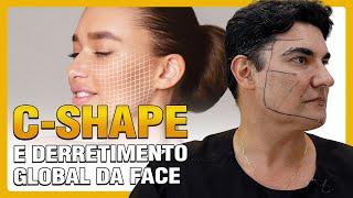 CSHAPE E DERRETIMENTO GLOBAL DA FACE [upl. by Sible]