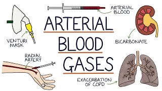 Understanding Arterial Blood Gases [upl. by Careaga874]