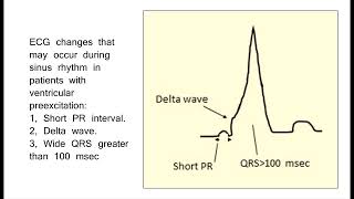 20 Ventricular Preexcitation [upl. by Rats253]