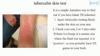 tuberculin skin test English  Medical terminology for medical students [upl. by Tnahsarp]