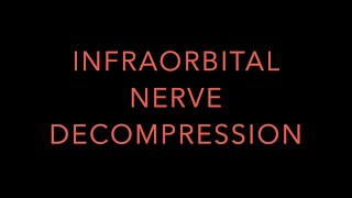 INFRAORBITAL NERVE DECOMPRESSION [upl. by Clayson36]