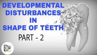 DEVELOPMENTAL DISTURBANCES IN SHAPE OF TEETH PART 2 [upl. by Eissim]