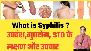 What is Syphilis । उपदंश गुप्तरोगSTD के लक्षण और उपचार l DrHarshad Raval MD Homeopath [upl. by Doll64]