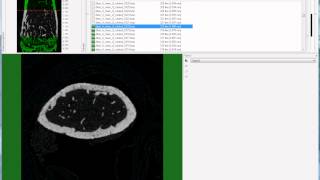 Bruker microCT tutorial Setting the trabecular VOI for the mouse femur [upl. by Roscoe853]