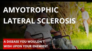 Amyotrophic Lateral Sclerosis [upl. by Oal460]