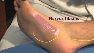 Motorische Neurographie  Tibialis [upl. by Nnylcaj]