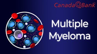 Multiple Myeloma [upl. by Ali]