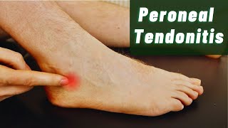 Peroneal Tendonitis Explained by Foot Specialists [upl. by Emmi]