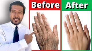 2 Fast Remedies for Dry and Wrinkled Hands THAT WORK [upl. by Ardyce]