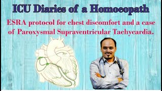 ESRA protocol for chest discomfort  Case of Paroxysmal Supraventricular Tachycardia [upl. by Jedidiah]