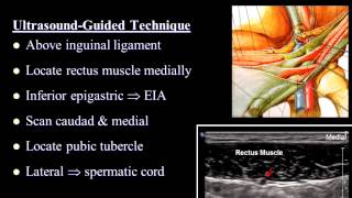 Pain Medicine  Ilioinguinal Nerve Iliohypogastric Nerve Inguinal Canal TAP [upl. by Theda]