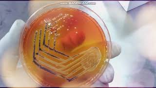 Xylose Lysine Deoxycholate agar  XLD  Selective medium for Salmonella and Shigella [upl. by Rianon190]